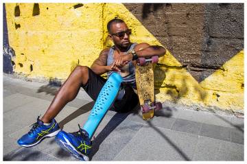 Stil sahibi protez bacaklar