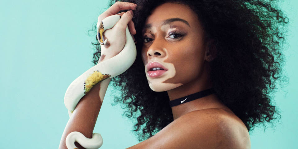 Güzellik standartlarını reddet, kendini sev