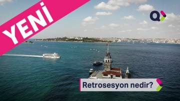 Retrosesyon nedir?